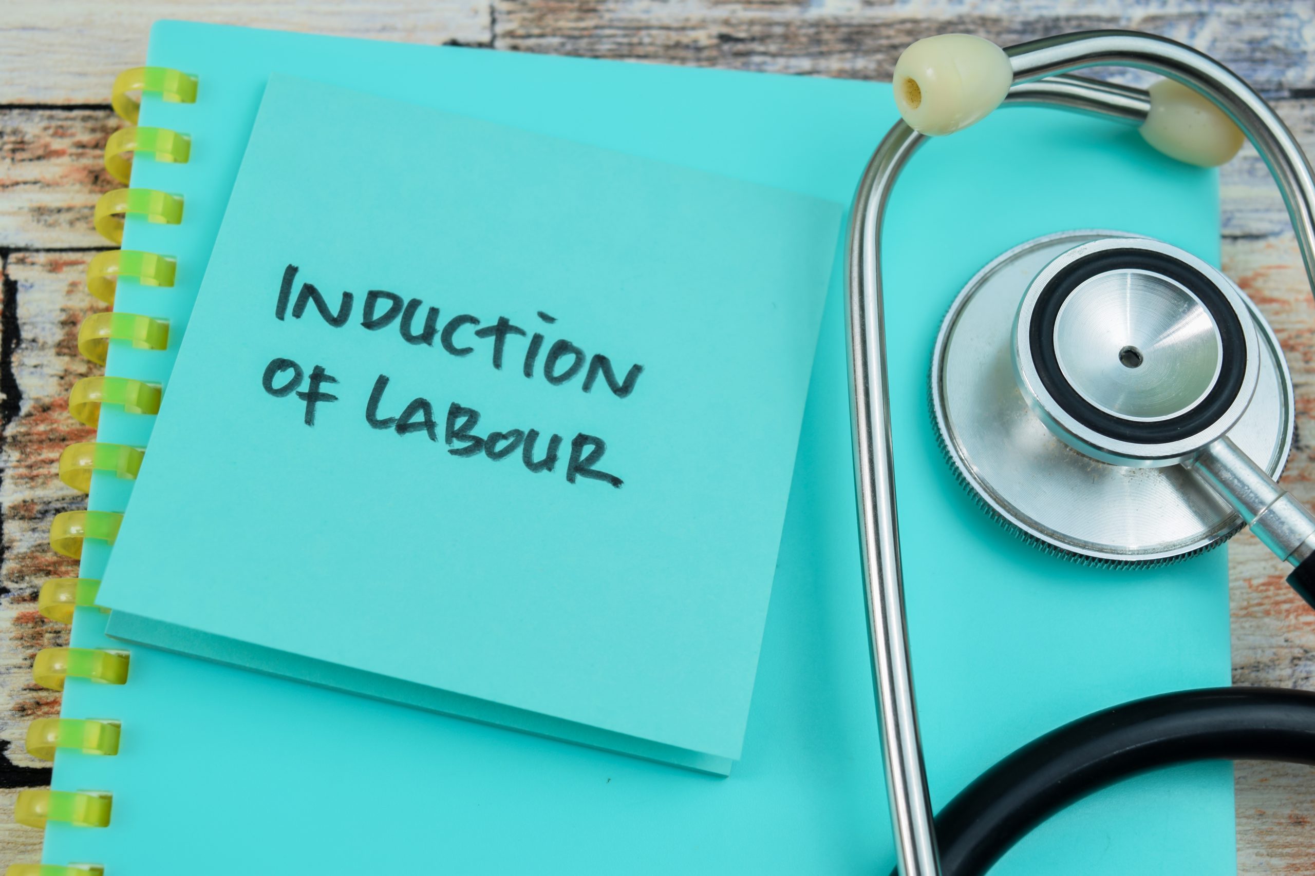 notepad with induction of labour written on it and a stethoscope by the side