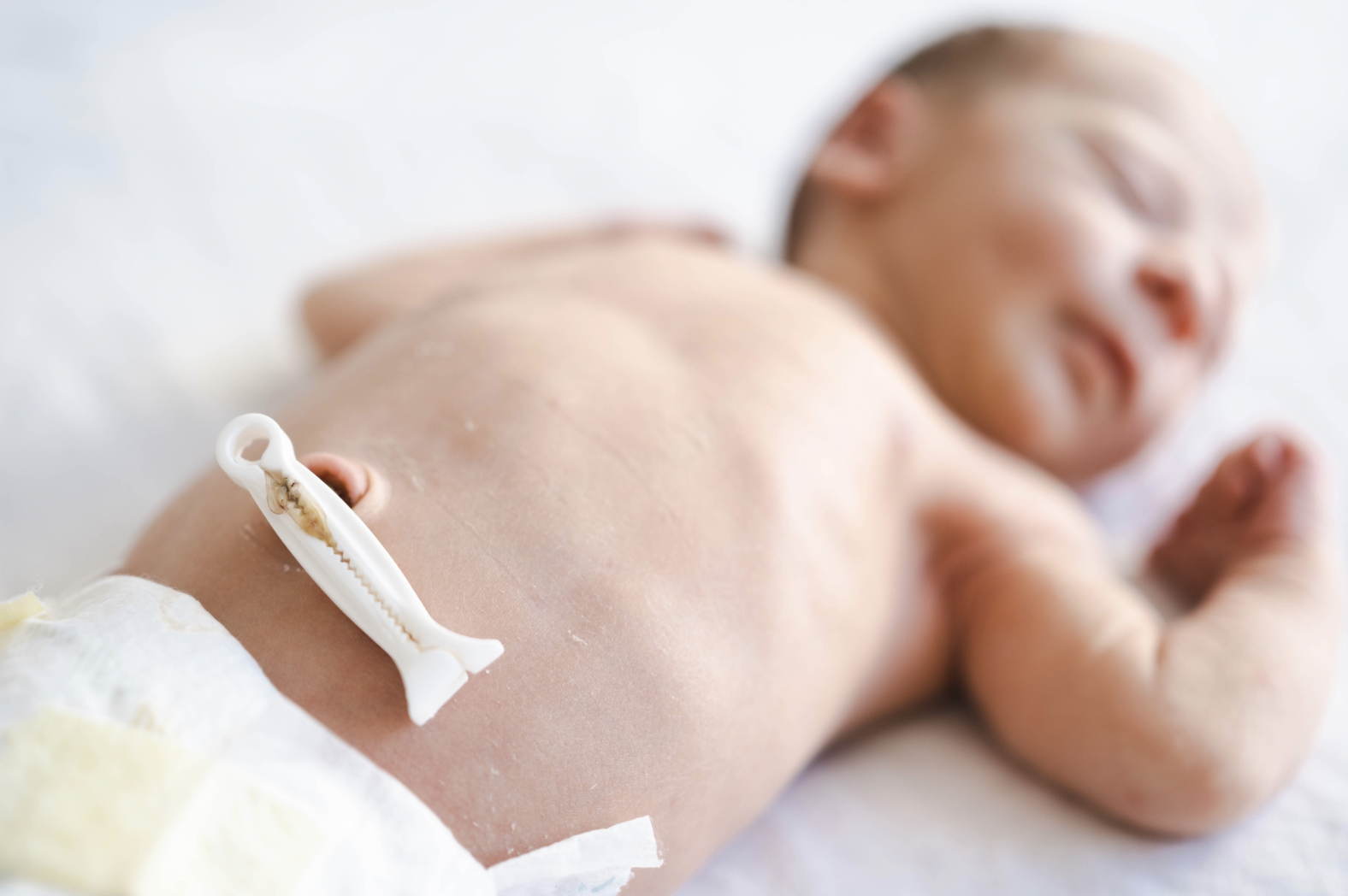 newborn baby with umbilical cord clamped