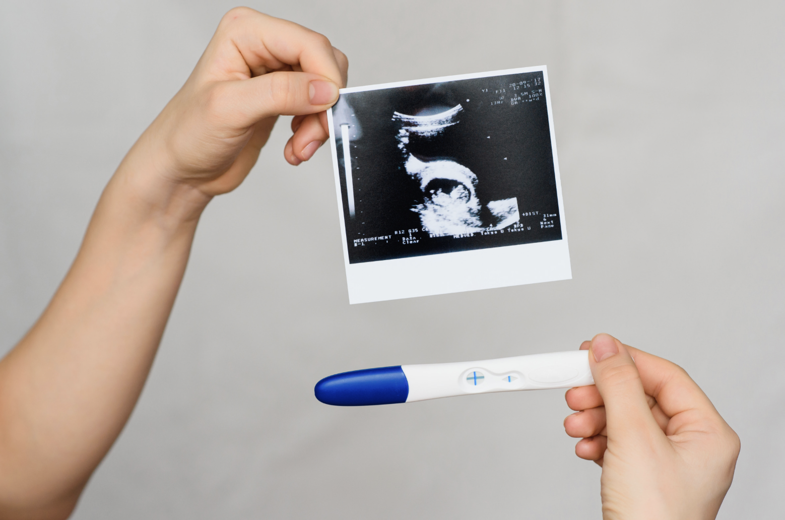 pregnancy test and pregnancy scan image