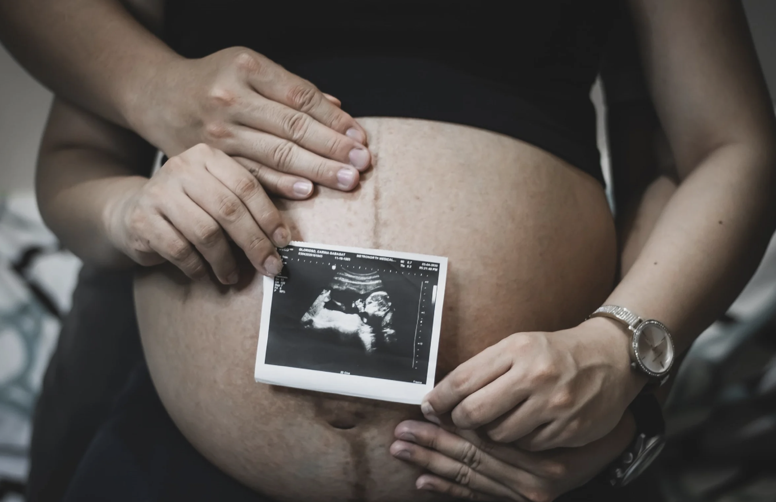 pregnant couple holding scan in front of bump