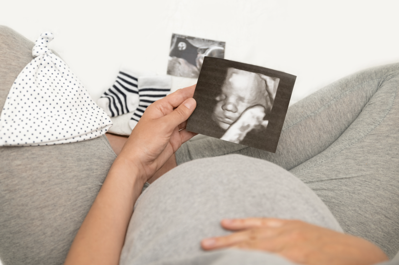pregnant lady holding ultrasound